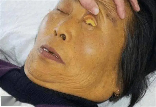 图片细节说明